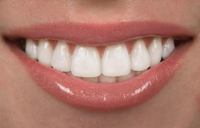Close-up of a bright, even smile